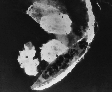 world war 2 featured stories thumbnail